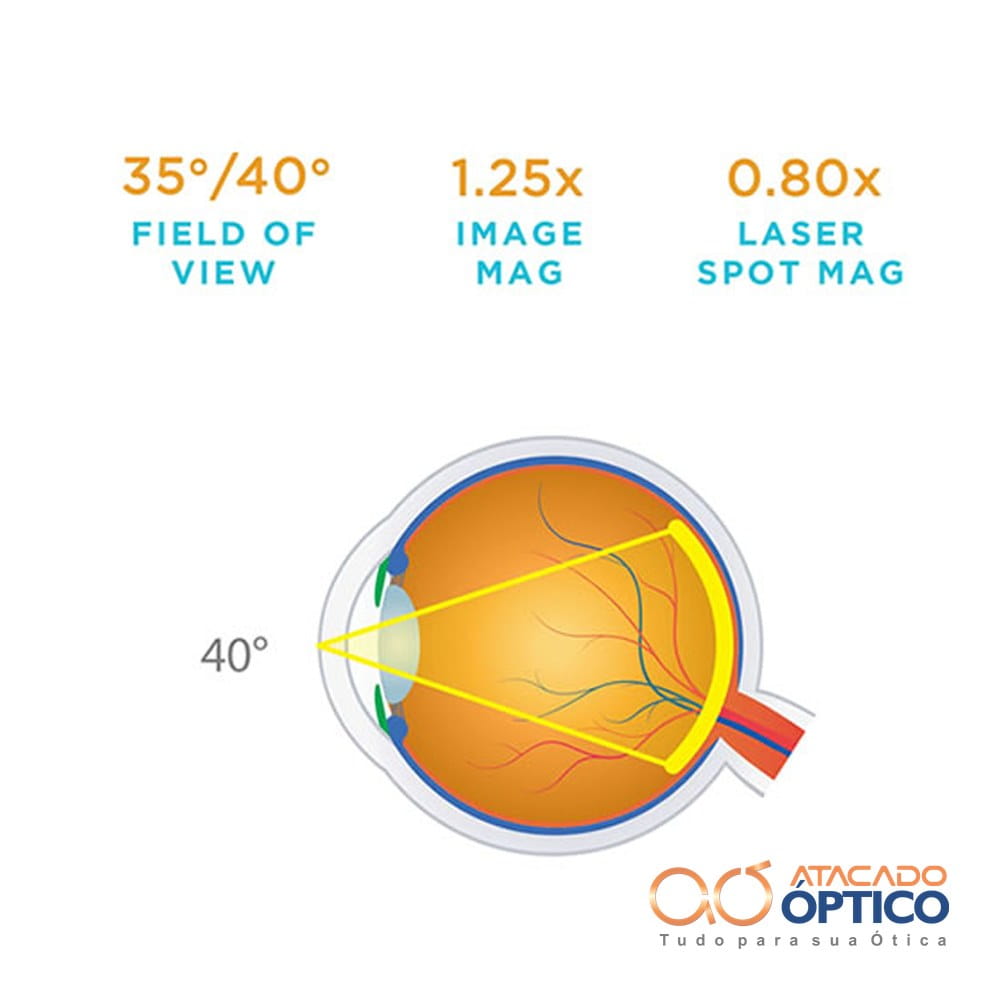Lente Fundus Laser 20mm — foto 2 — Equipamentos Atacado Optico