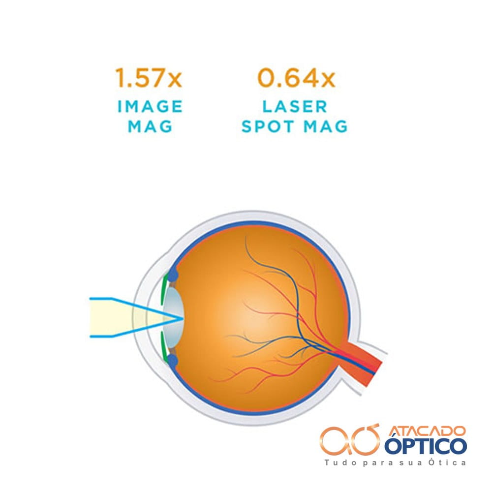 Lente Capsulotomy — foto 2 — Equipamentos Atacado Optico