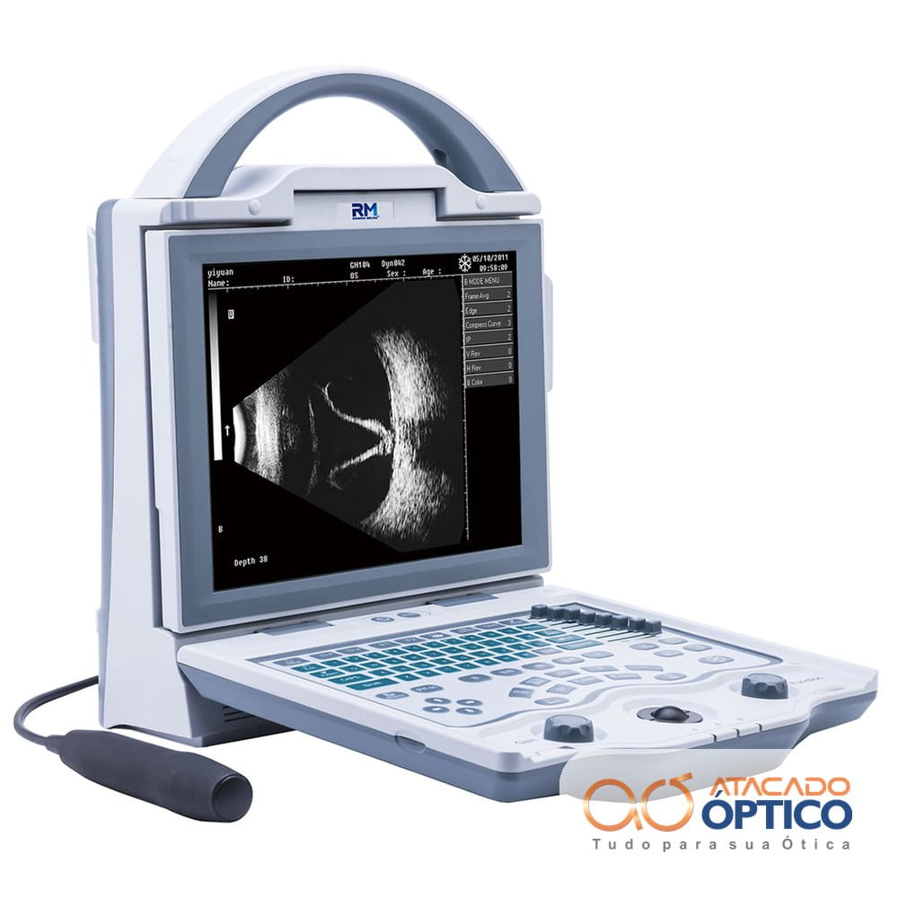 Ultrassom B Scan — Equipamentos Atacado Optico